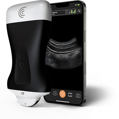 C7 HD3 Microconvex Handheld Portable Wireless Ultrasound Scanner