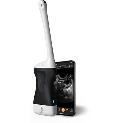 EC7 HD3 Endocavity Handheld Portable Wireless Ultrasound Scanner