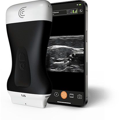 L15 HD3 High Freq Linear Handheld Portable Wireless Ultrasound Scanner