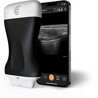 L7 HD3 Linear Handheld Portable Wireless Ultrasound Scanner