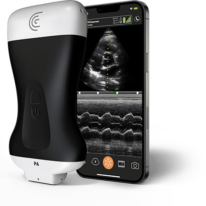 PA HD3 Phased Array Handheld Portable Wireless Ultrasound Scanner