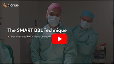 Video The Smart BBL Technique